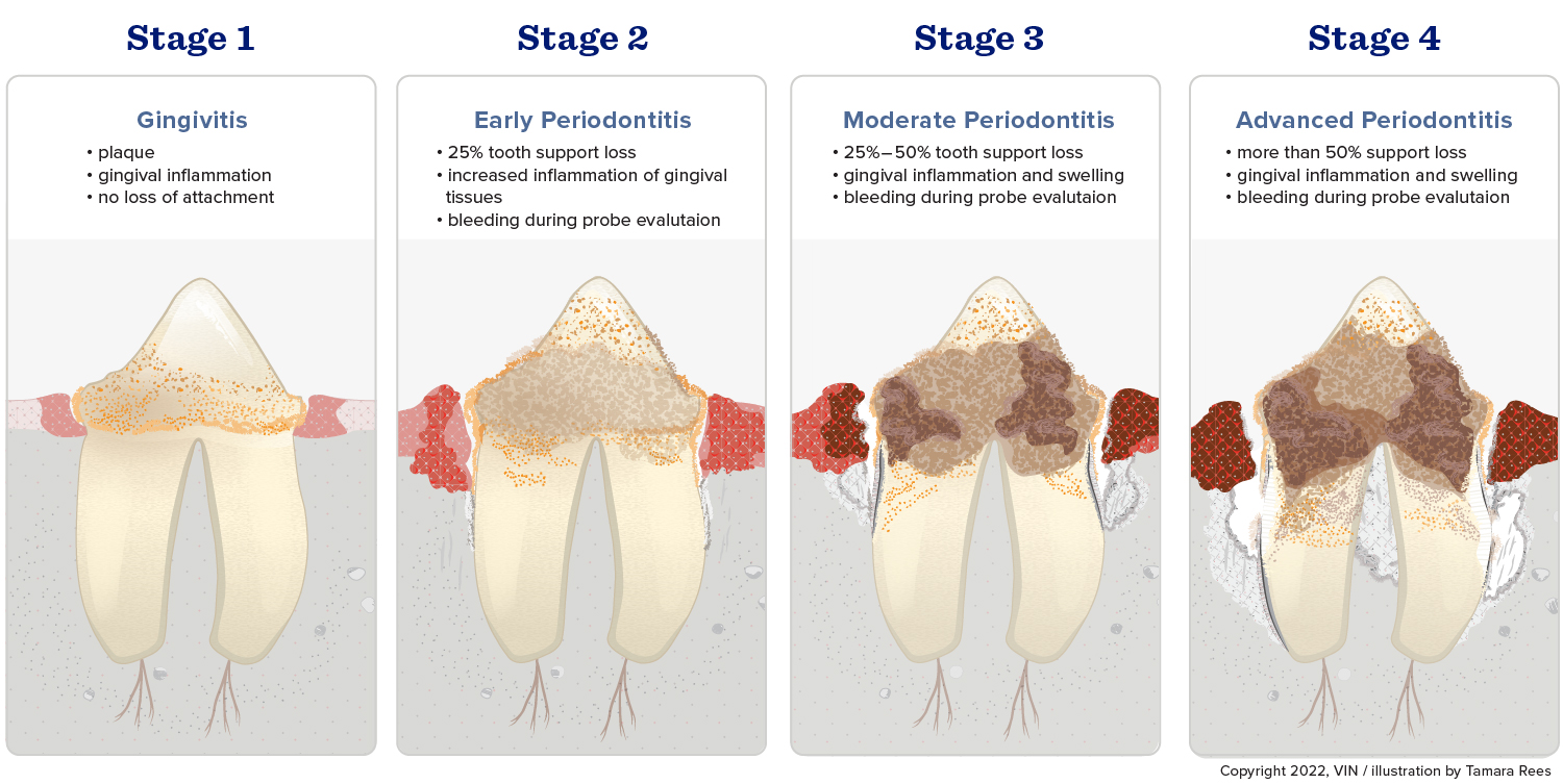 Periodontitis Progression